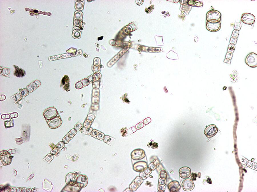 43_melosira_100x.jpg